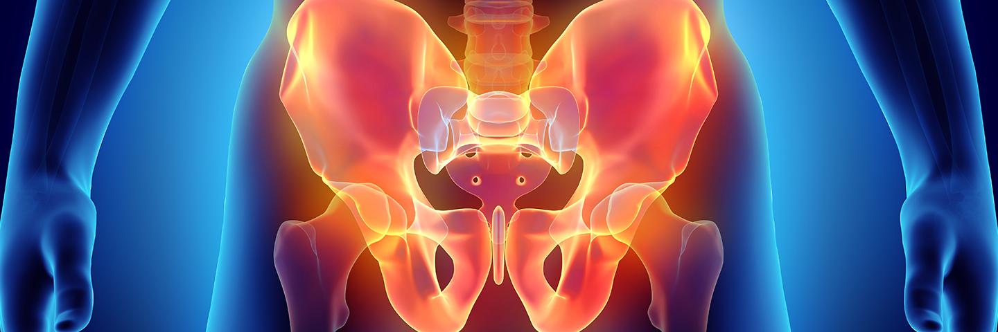 Image of an X-ray of a pelvic area