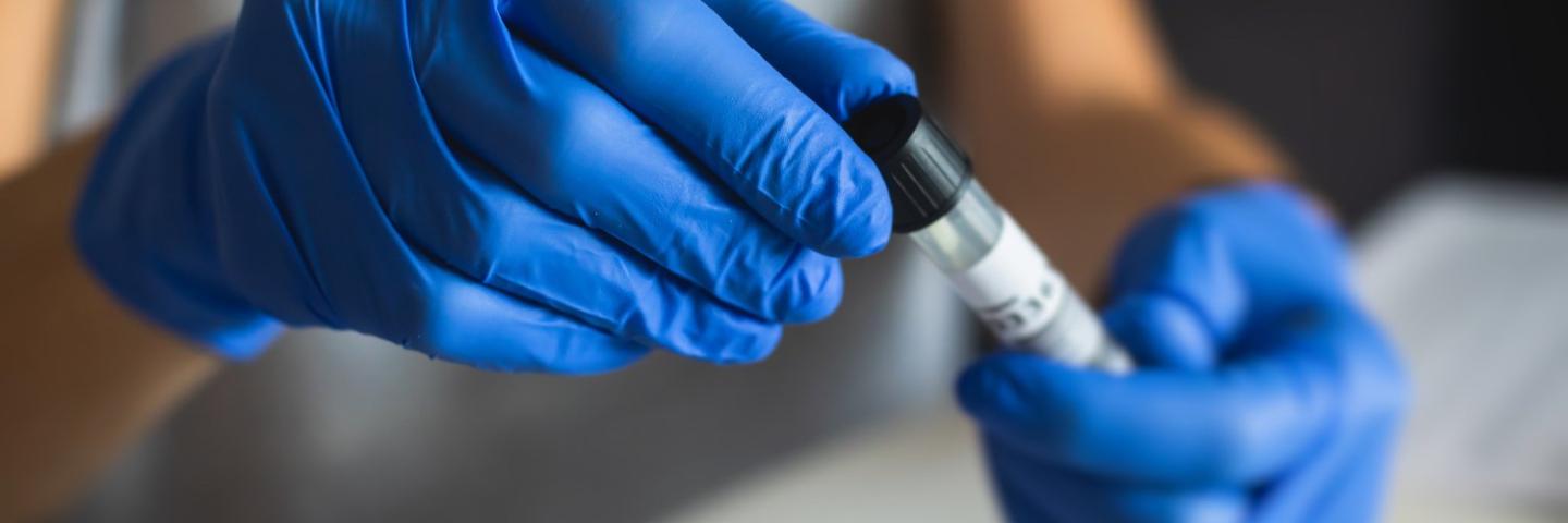 Lab Tech taking a sample for testing at a patients home